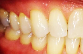 Best Advanced Gum Treatment Clinic in Nangloi