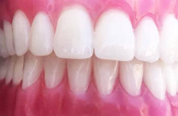 Best Dentures Clinic in Nangloi